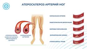 Герметизация раны грудной клетки: необходимые материалы и методы в Mirra